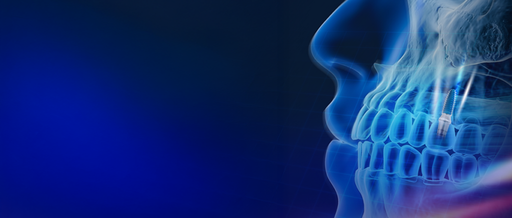 Solve any prosthetic case with confidence