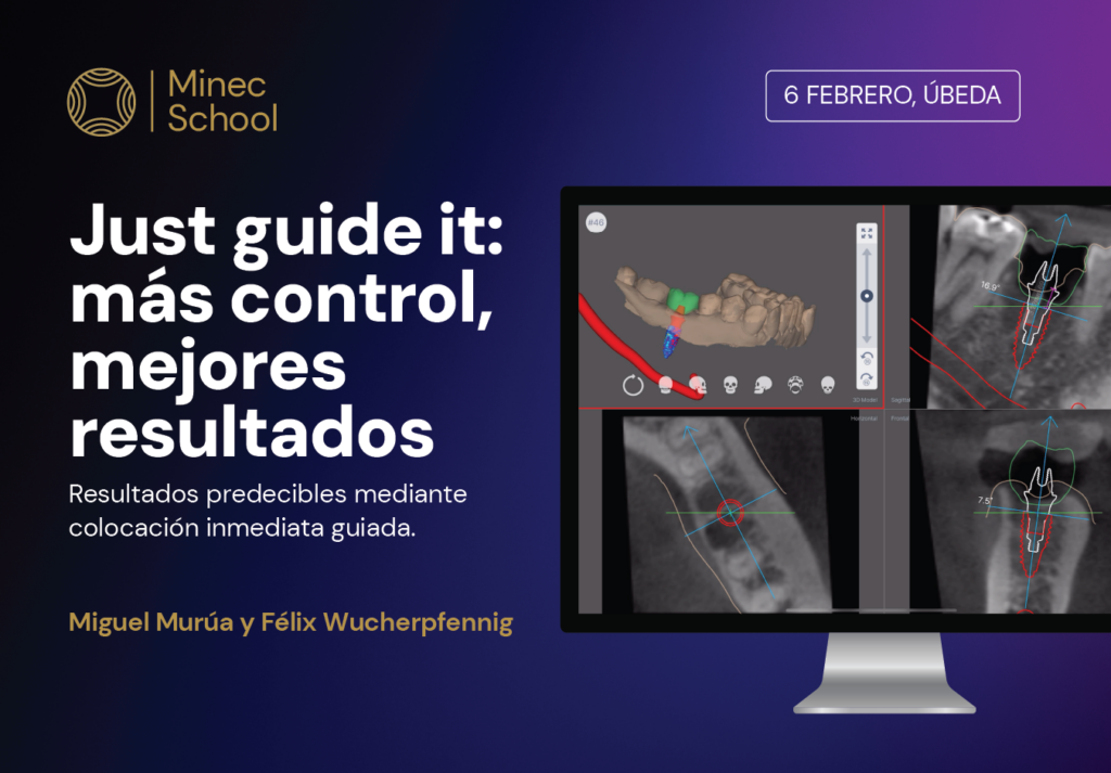 Privado: Just guide it: más control, mejores resultados